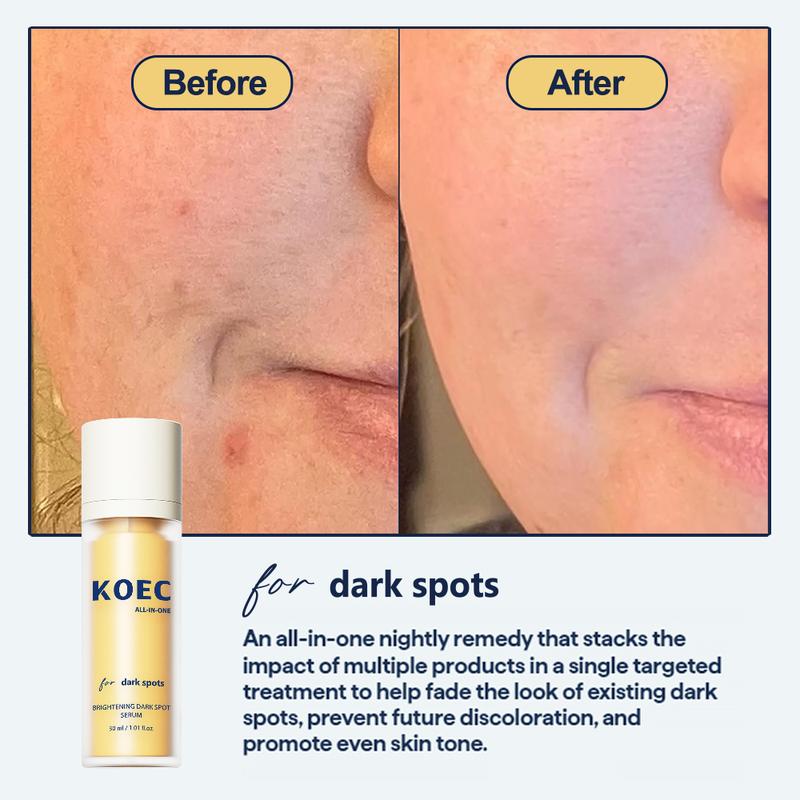 KOEC for dark spots | All-in-one dark spot correcting treatment