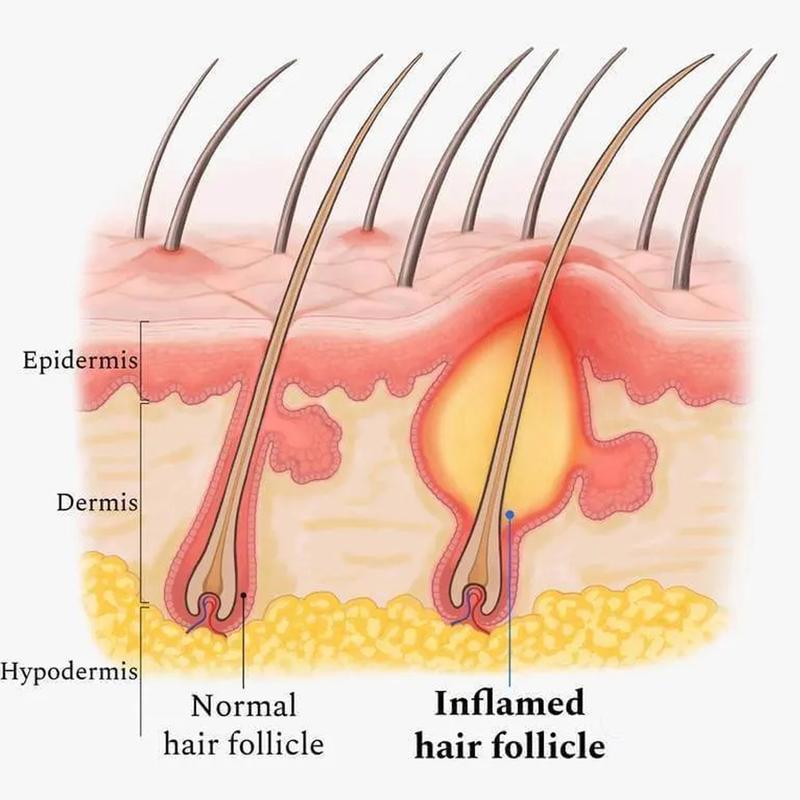 EELHOE Essential Oil For Scalp, And Hair Scalp Deep Cleaning And Repair Hair Root Anti-Itching And Anti-Loss Hair Solid Care Essential Oil