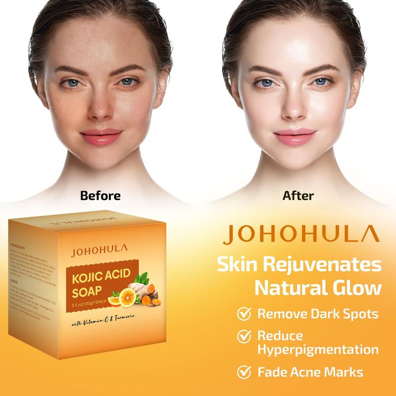 Johohula Turmeric Kojic Acid Soap: Dark Spot Corrector with Vitamin C, Retinol, Collagen. Smooths, firms, brightens. For face & body. 3 x 100g bars