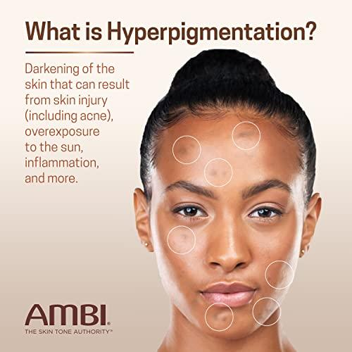 Ambi Even & Clear Advanced Fade Cream - Hydroquinone-free Hyperpigmentation Treatment - Skincare, Moisturizers