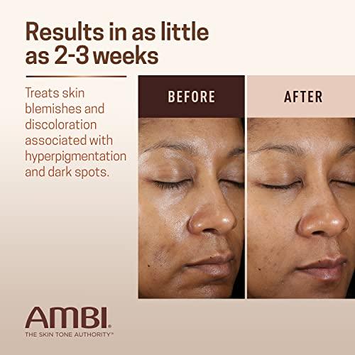 Ambi Even & Clear Advanced Fade Cream - Hydroquinone-free Hyperpigmentation Treatment - Skincare, Moisturizers