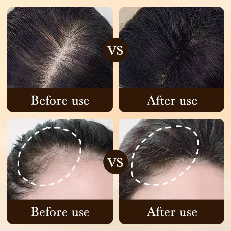 Restore Your Hair Glory: Unlock the Magic of Hair Growth TonicNew Serum that Works in 2 Weeks Hair Treatments