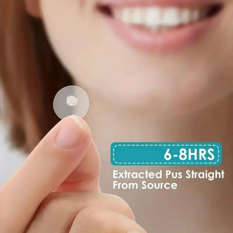 Hydrocolloid Acne Patches, 400 720pcs Acne Covering Sticker, Facial Acne Care Patches, Skin Care Products for Women & Men