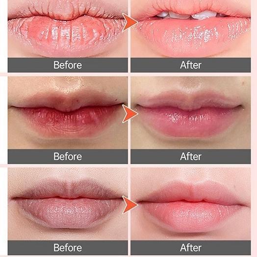 4-in-1 Lip Treatment – Bubble Balm for Makeup Removal & Nourishing Moisture