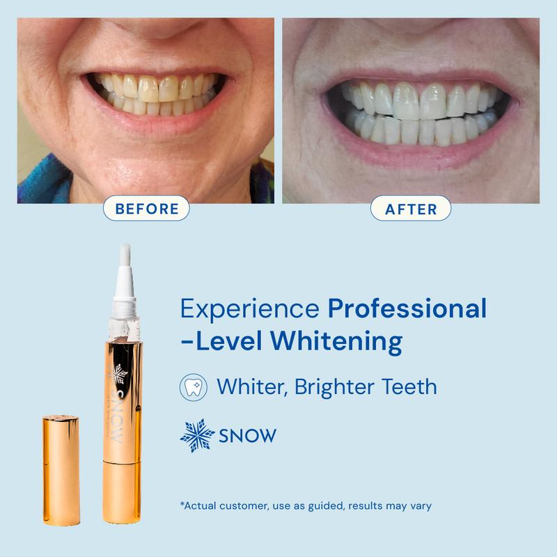 Snow Extra-Strength Teeth Whitening Serum | Oral Care Teeth Whitener Pen | Whitening Pen for Stain Removal & Whiter Teeth